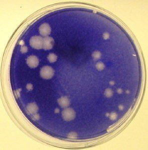 Now playing: Viral plaque formation Virology Blog