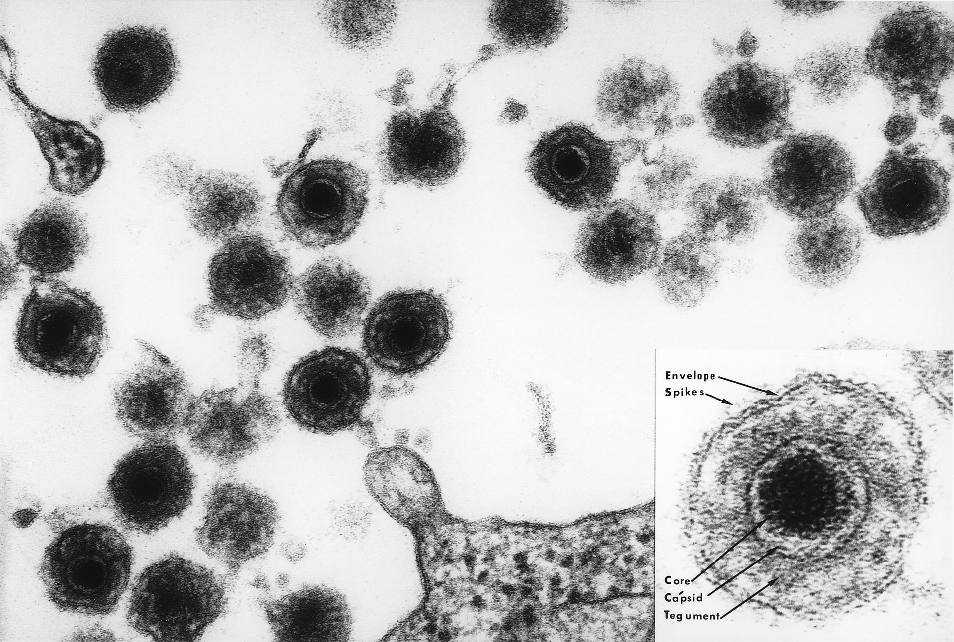 a-herpesvirus-associated-with-female-infertility